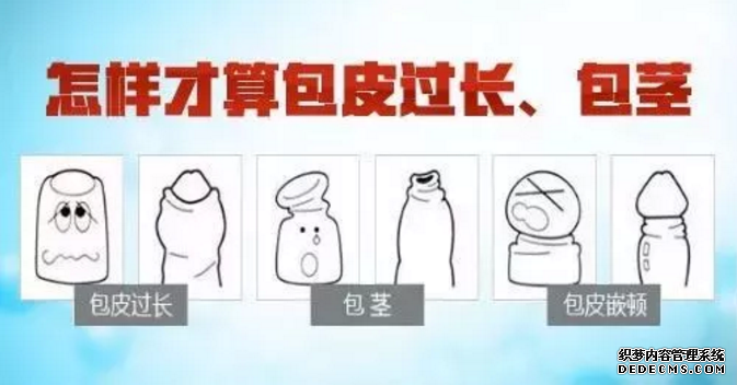 赤峰包皮过长还分“真假”“假的”就不用割吗？