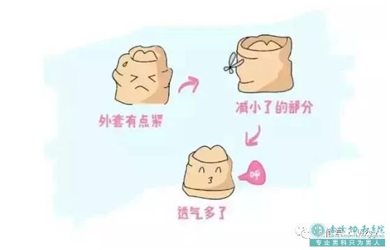 宝鸡包皮可以自己割吗？你包皮男吗？
