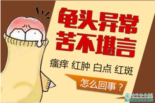 宝鸡男科：龟头有白色物质是什么病