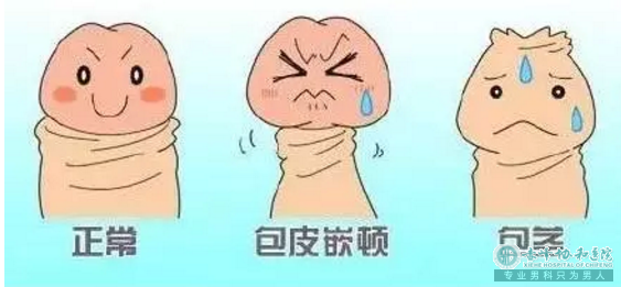 宝鸡松山区做包皮手术男科医院电话